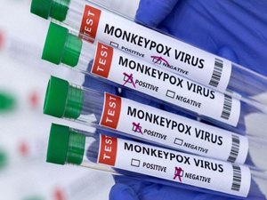 Municípios de Pariconha e Batalha registram casos suspeitos da Varíola dos Macacos