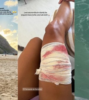 Turista é mordida por tubarão durante mergulho em Fernando de Noronha