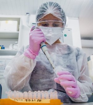 Lacen recebeu mais de 29 mil exames RT-PCR em 2021 e liberou quase 28 mil resultados