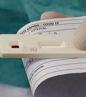 Hospitais e laboratórios já priorizam teste de Covid para doente grave