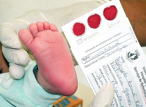 Ampliação do teste do pezinho no SUS ajudará no diagnóstico de doenças raras
