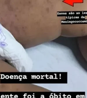 HGE confirma morte de bebê de um ano por meningite