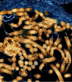 Surto: CDC da África confirma 395 casos de ebola e 106 mortes