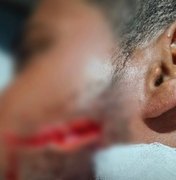 Jovem é atingido por facada no rosto durante vaquejada em Delmiro Gouveia
