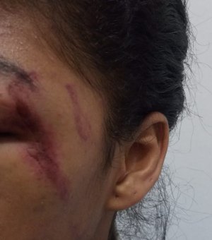 Mulher é agredida no rosto pelo marido em Maceió
