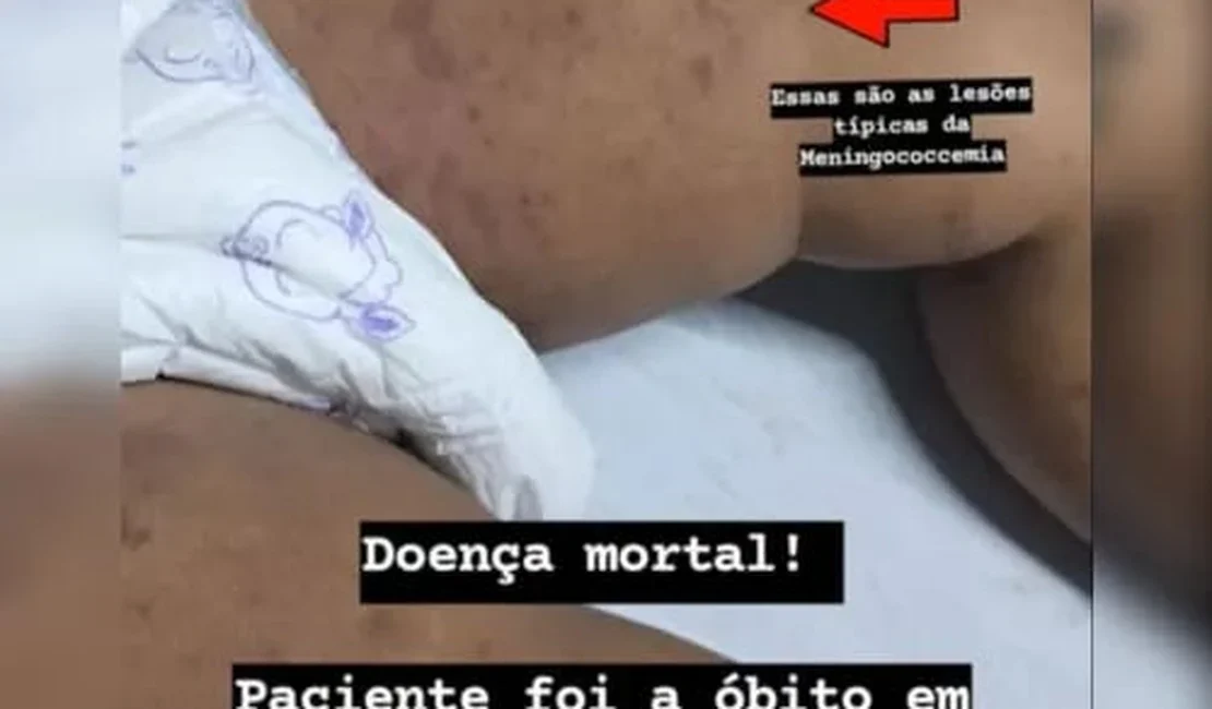 HGE confirma morte de bebê de um ano por meningite