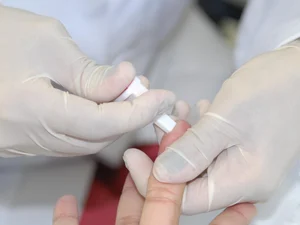 Secretaria de Saúde orienta como prevenir, diagnosticar e tratar as hepatites virais