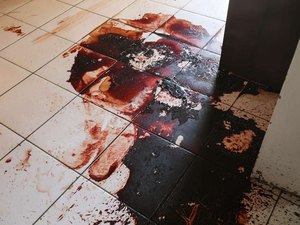 Perito vê sinais de tiro à queima-roupa em corpo de Adriano