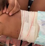 Bebê é atingida por rojão após discussão por uso de máscara em bar