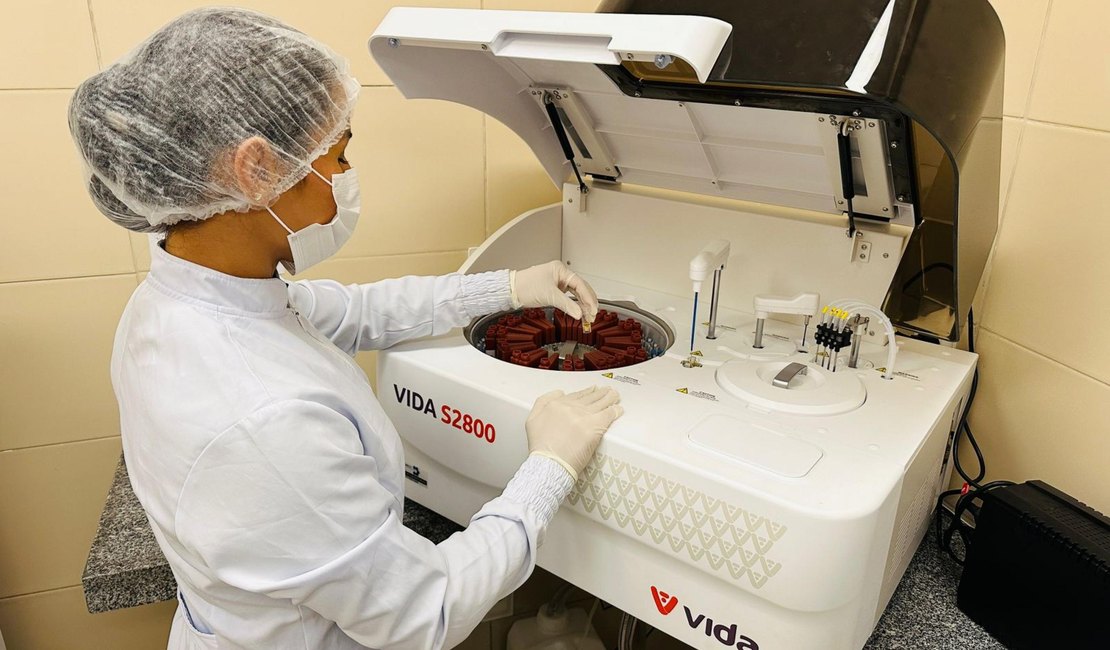 Hospital Regional de Palmeira dos Índios agiliza diagnósticos com exames realizados em até 30 minutos