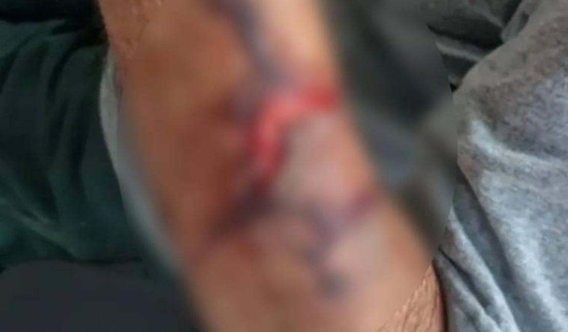 Idoso de 82 anos é agredido com capacetadas durante roubo de R$ 10 mil em Delmiro Gouveia
