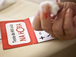 Fiocruz: estudo aponta medicamento de ação prolongada contra HIV