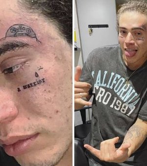Whindersson faz novas tatuagens no rosto e fãs se preocupam