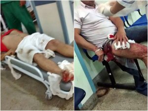Irmãos são vítimas de tentativa de homicídio na Região Metropolitana da capital