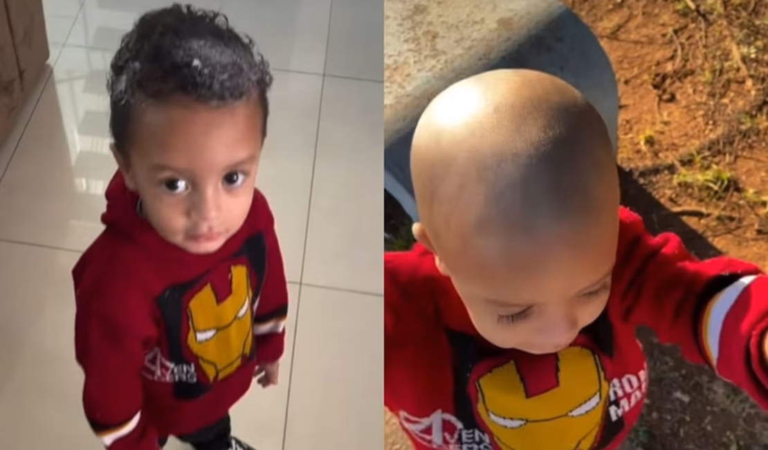 Criança usa creme depilatório na cabeça e perde o cabelo