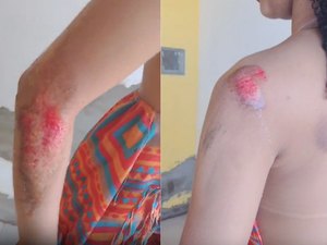 Jovem pula de moto por aplicativo após suspeitar de tentativa de estupro