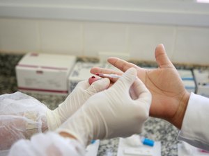 Alagoas registra aumento de casos confirmados de HIV