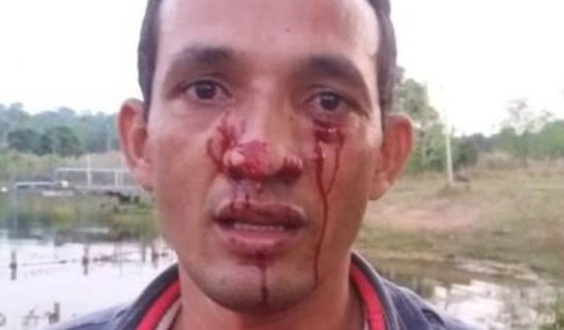Homem é atacado durante pescaria por sucuri de 3 metros que o atinge no rosto