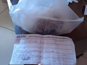 Jovem perde rim após ser baleado e hospital entrega órgão à família em saco plástico na Bahia