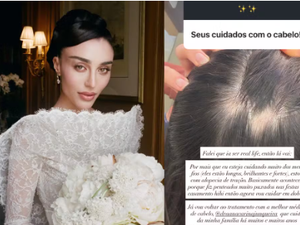 Elisa Zarzur revela alopecia após penteados do casamento: 'Vou cuidar em dobro'