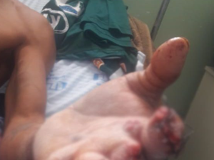 Suposta denúncia de desvio de água pode ter motivado tentativa de homicídio no Sertão