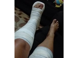 Mulher pula de muro de quase três metros para fugir de agressões do marido