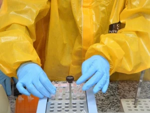 Estado vai ampliar exame de RT-PCR para alagoanos com síndrome gripal