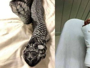Mulher usa meia-calça de 'cobra', assusta o marido e vai parar no hospital 
