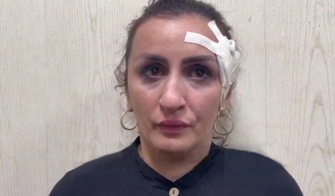Mãe é presa após vender bebê para pagar operação de R$ 19.000 no nariz