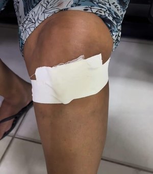 Homem vê assalto, reage e acaba atirando em moradora no Pilar