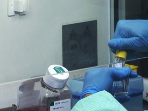 Cientistas brasileiros pesquisam a cura para a Aids