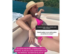 Larissa Manoela exibe estrias e fala sobre normalizar: 'Marcas de evolução'