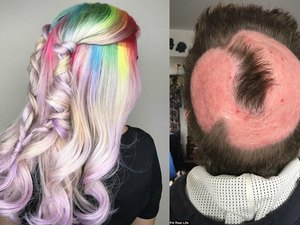 Mulher perde couro cabeludo por tentar fazer cabelo de unicórnio