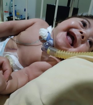 Pais de bebê com doença rara lutam para ter condições de levar filho para casa em Arapiraca