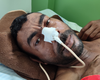 Hospital de Emergência do Agreste apela para localizar familiares de paciente que sofreu acidente