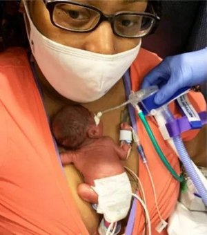 Nascido com 21 semanas, bebê bate recorde de mais novo prematuro a sobreviver