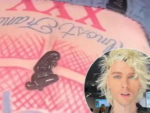 Machine Gun Kelly choca fãs ao mostrar sanguessugas na barriga: 'Melhores amigos'