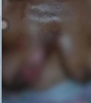 Mulher tem seios queimados com óleo quente pelo marido no Sertão de Alagoas; suspeito fugiu