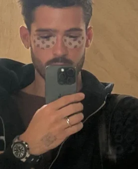 João Guilherme posa de saia e ganha elogios dos fãs na web
