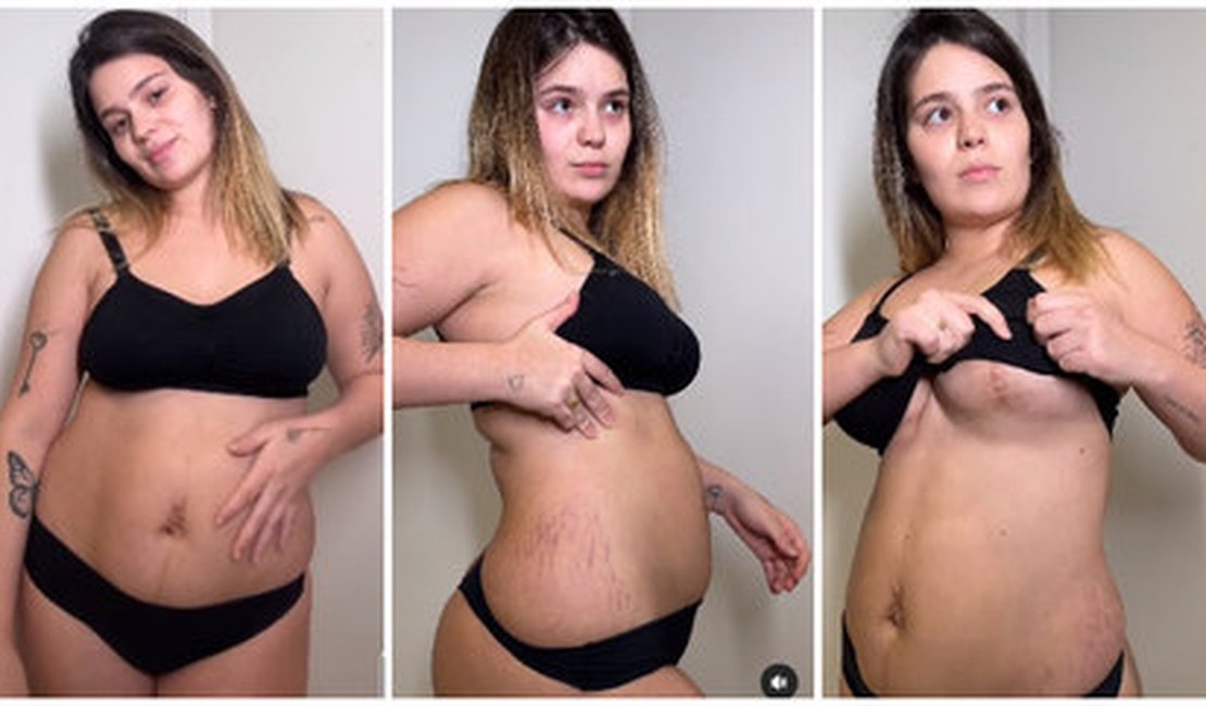 Viih Tube mostra marcas no corpo um mês após parto: 'Minhas cicatrizes contam uma história'