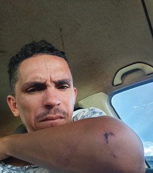 Pedreiro de Arapiraca ferido ao fugir de confusão em Santa Catarina consegue voltar para casa