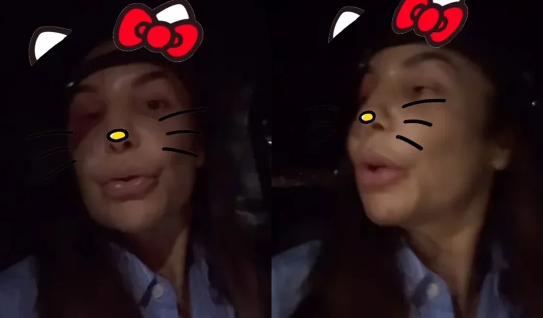 Em casa, Ivete Sangalo ganha carinho das filhas após cirurgia delicada