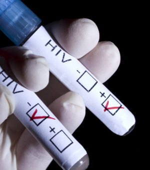 Autoteste de HIV estará disponível nacionalmente até o fim do mês nas farmácias 