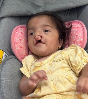 Família faz rifa para custear cirurgias de bebê nascida com malformações
