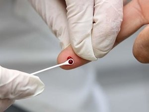 Segundo Secretaria de Saúde, casos de Aids caem 400% em Arapiraca