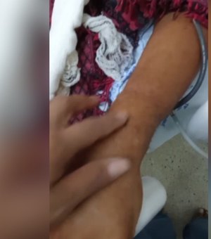 Família de paciente custodiado relata suposta negligência em atendimento no HEA, em Arapiraca