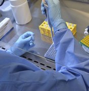Universidade de Brasília e HUB iniciam teste de vacina contra covid-19
