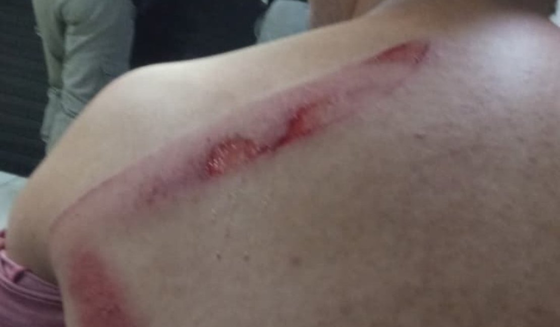 Homem é atacado com faca ao defender mãe que comemorava vitória de Lula em Maceió