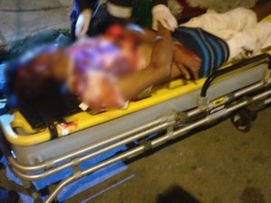 Homem sofre atentado e é atingido por disparos de arma de fogo na cabeça