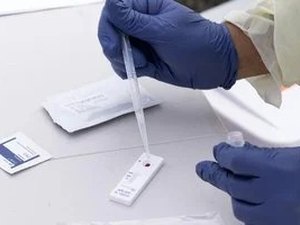 Plano de saúde negou teste de covid-19? É possível recorrer